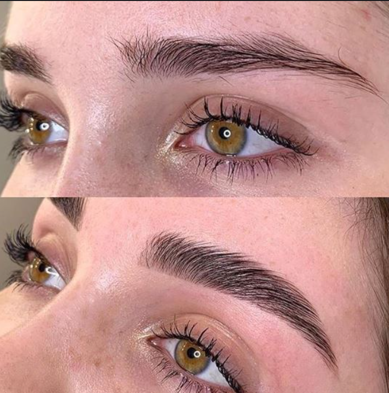 Turkish Eyebrows With Treatment
